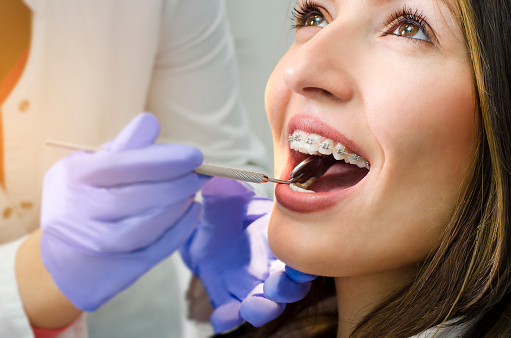 Young woman with braces in dentist chair while hygienist inspects her mouth with a mirror