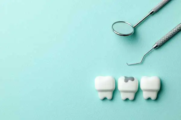 dental filling 5