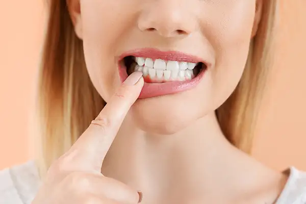 periodontal care 3