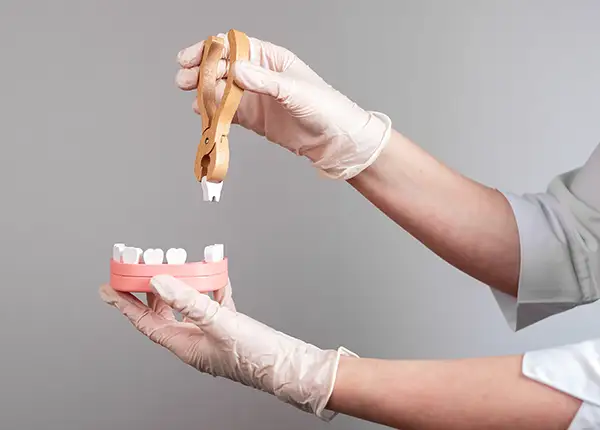tooth extraction 3