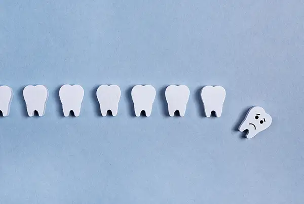 A row of tooth models with one sad tooth separated from the rest, representing the concept of tooth loss.