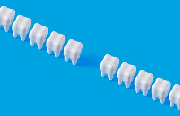 tooth loss 5